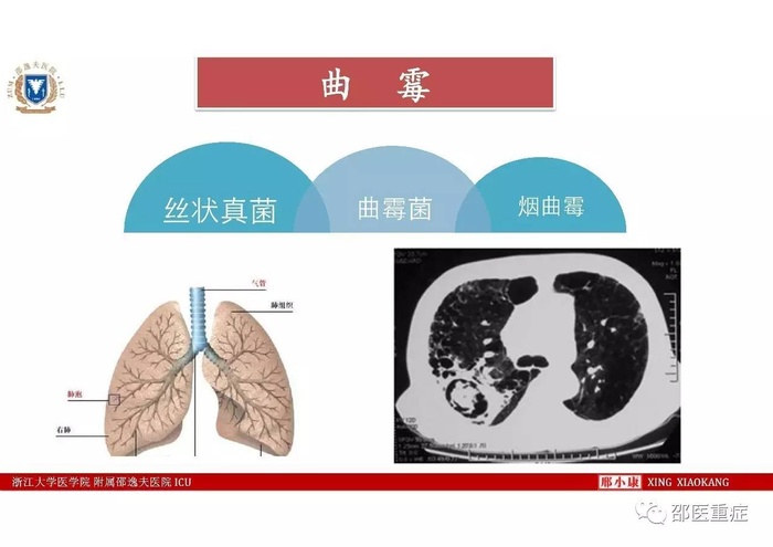 http://webres.medlive.cn/upload/000/336/499