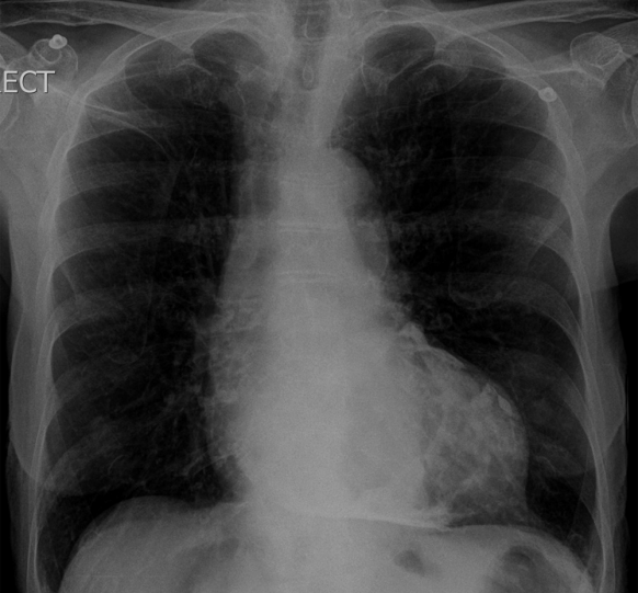 http://webres.medlive.cn/upload/000/357/336