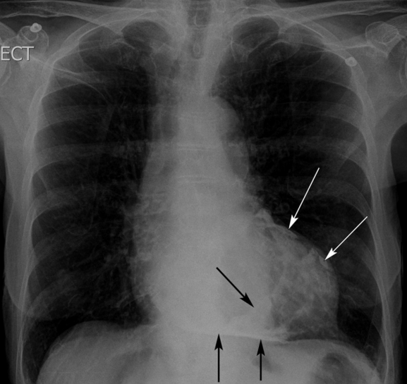 http://webres.medlive.cn/upload/000/361/380