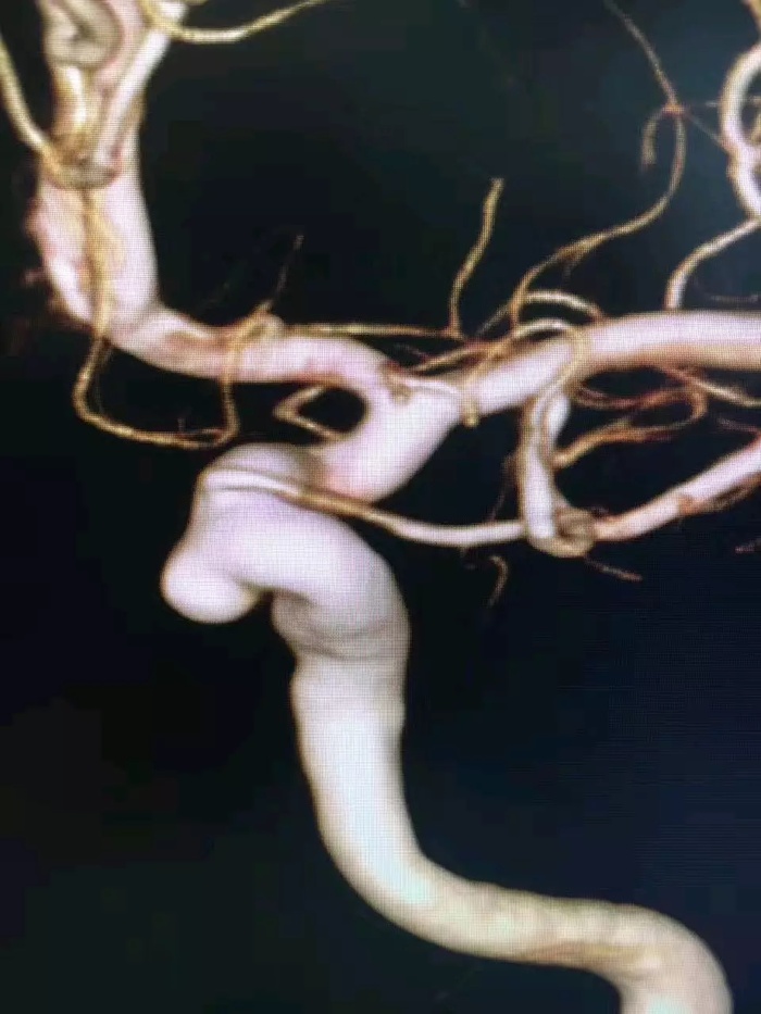 http://webres.medlive.cn/upload/000/364/044
