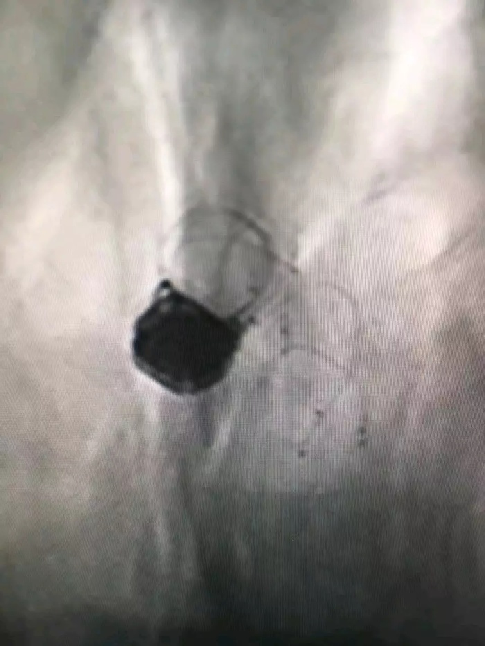 http://webres.medlive.cn/upload/000/364/045
