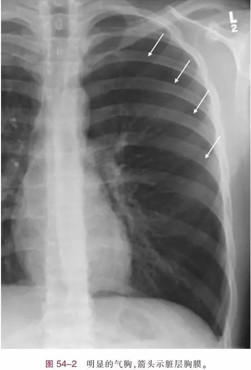 http://webres.medlive.cn/upload/000/386/600