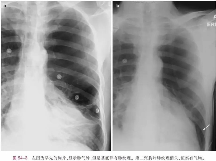 http://webres.medlive.cn/upload/000/386/601