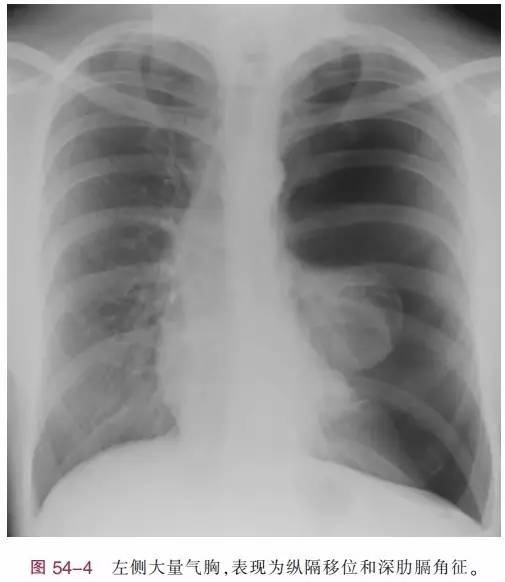http://webres.medlive.cn/upload/000/386/602