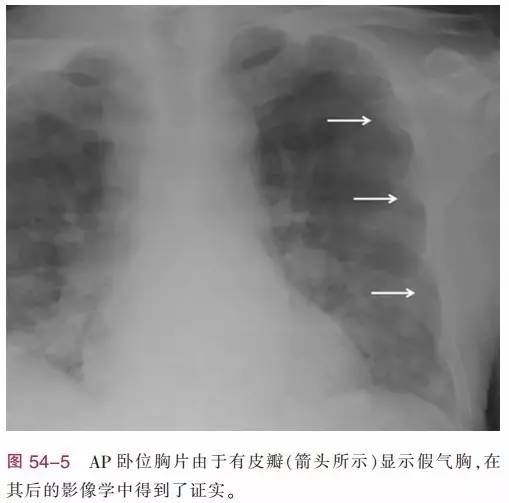http://webres.medlive.cn/upload/000/386/603