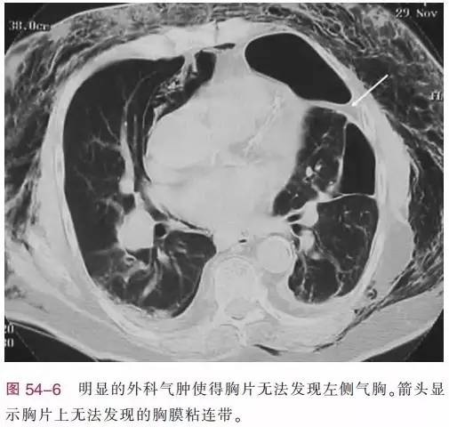 http://webres.medlive.cn/upload/000/386/605