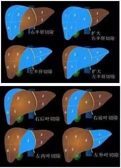 http://webres.medlive.cn/upload/000/516/242