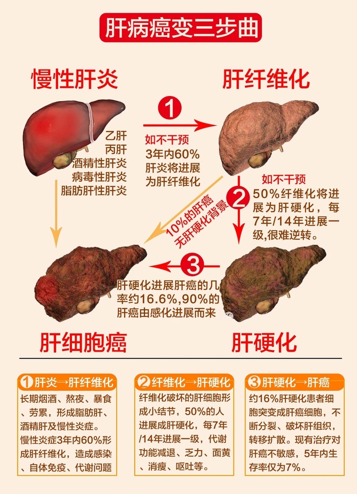http://webres.medlive.cn/upload/001/407/541