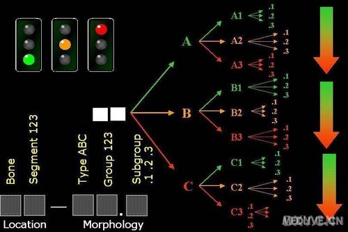 骨折ao分型原则及各种分型图片