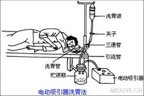 洗胃步骤流程图PPT图片