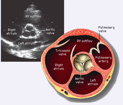 二维超声心动图常用切面及选择