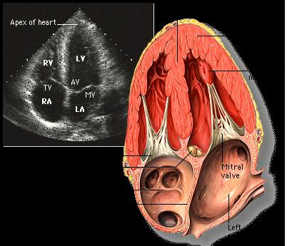 二维超声心动图常用切面及选择