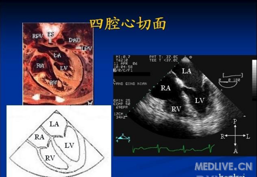 经食道超声心动图常用标准切面