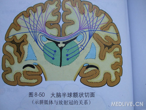 大脑放射冠图片