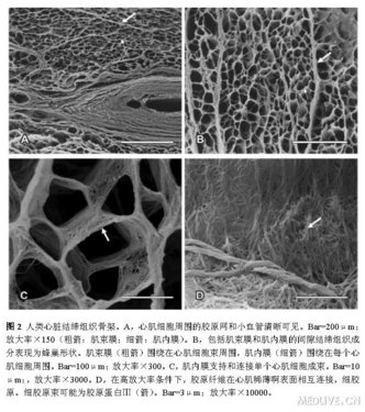 电镜扫描揭示人类心脏心肌和结缔组织三维结构