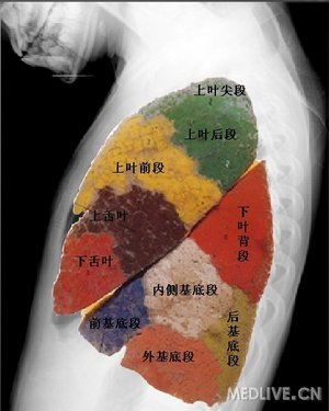 学习阅片之一正常胸片成人