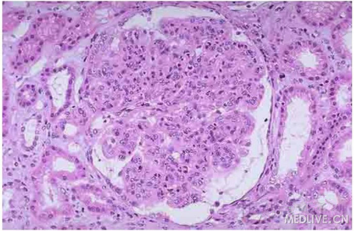 medlive.cn/upload/000/113/927