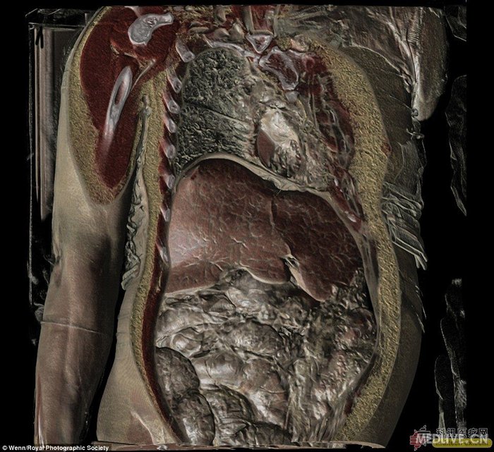 上图为人体标本照片上图为热成像下的耀眼人体上图展示了科学研究中