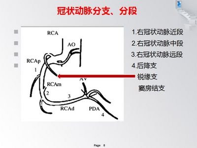 多媒体msct冠状动脉解剖及钙化评分应用