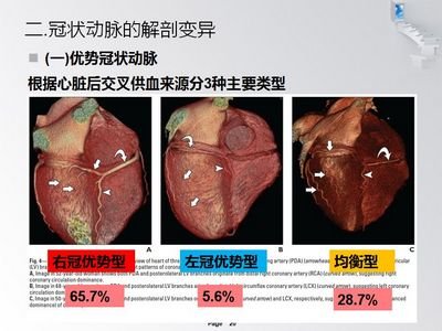 多媒體msct冠狀動脈解剖及鈣化評分應用