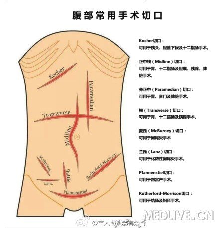 腹部皮瓣手术图解图片