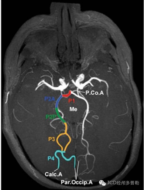 图片详细讲解大脑后动脉分段