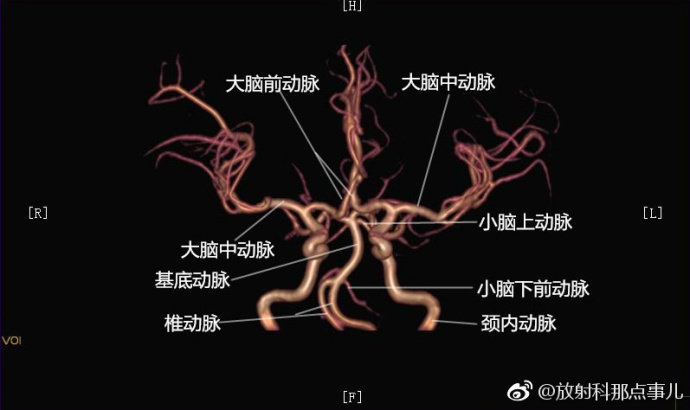 快考试了吧看图颅内血管解剖