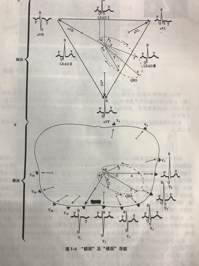 横面)的平面心电向量图,再投影在不同的导联轴上则可获得相应导联的心